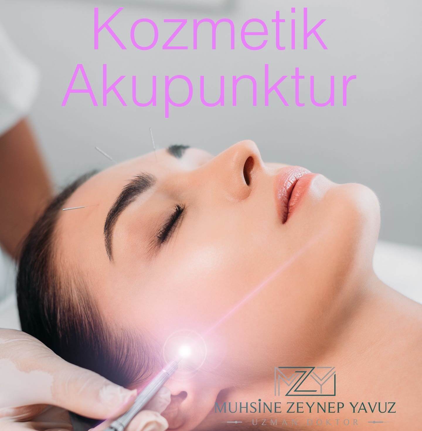 Akupunktur ile zayıflama, migren, sigara, bırakma fiyatları İstanbul