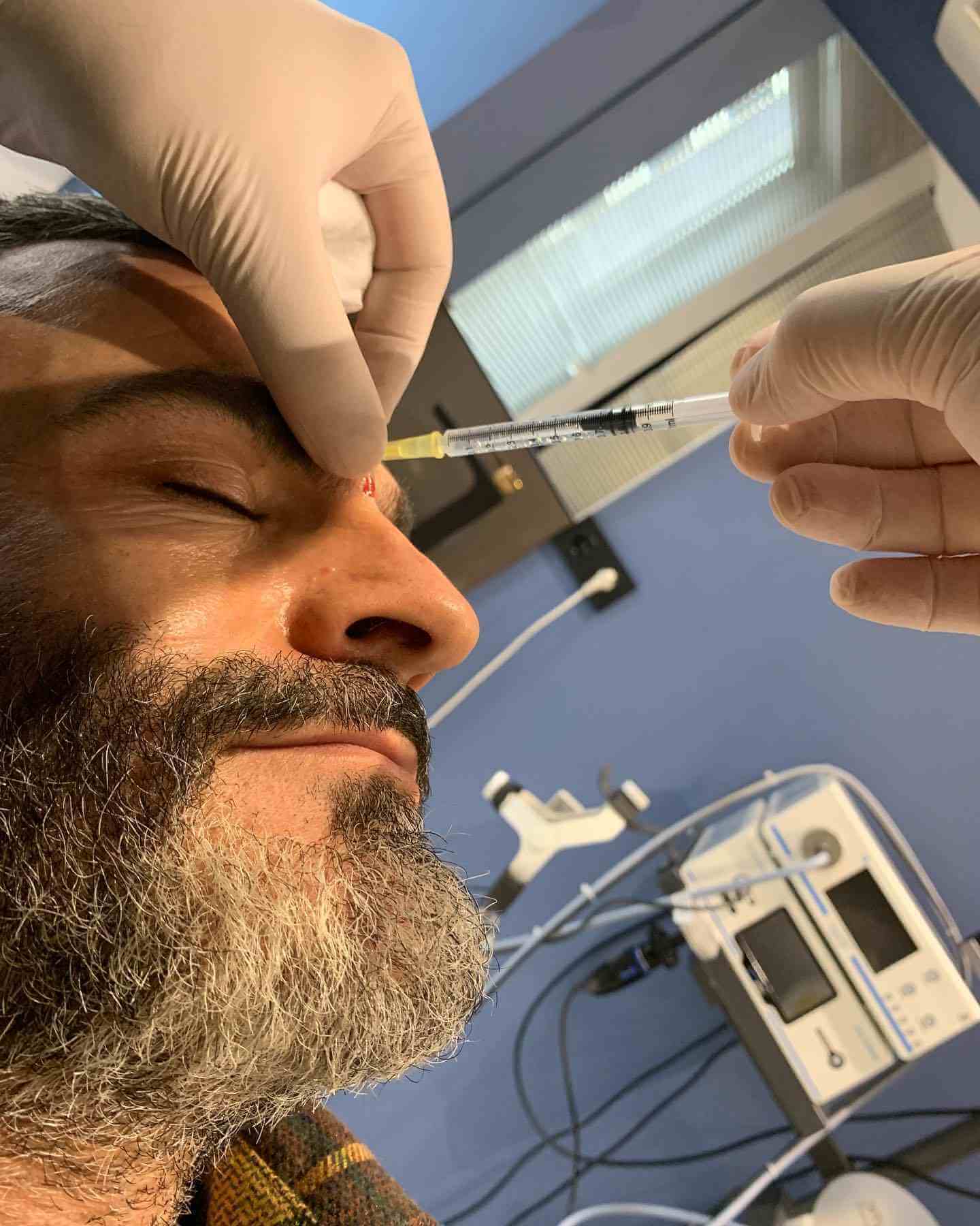 Botox botox
