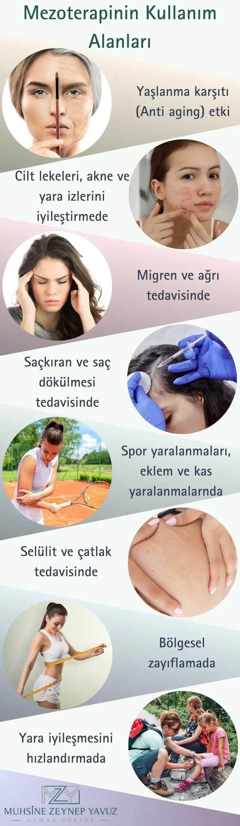 Mezoterapinin Kullanım Alanları İstanbul