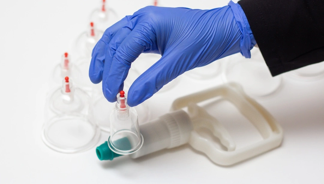 what-to-do-before-and-after-hijama-cupping-istanbul